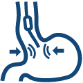 ARMS (leczenie refluksu)