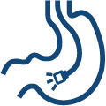 gastroskopia